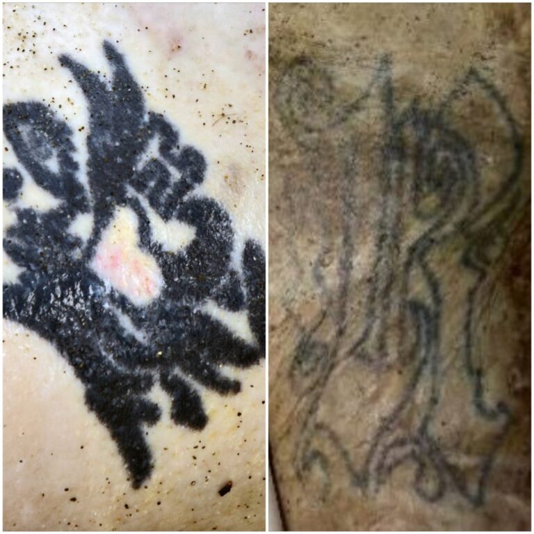 Rodia, il mistero del corpo ritrovato in spiaggia lo scorso 18 aprile. La Procura diffonde le foto dei tatuaggi